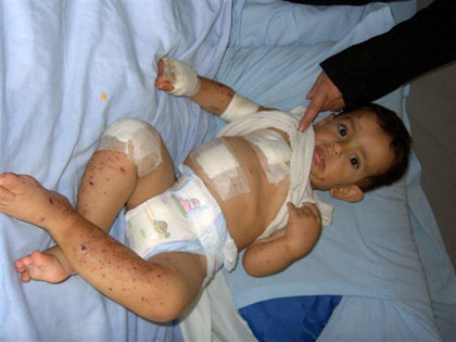 Wounded Baby Lebanon 420